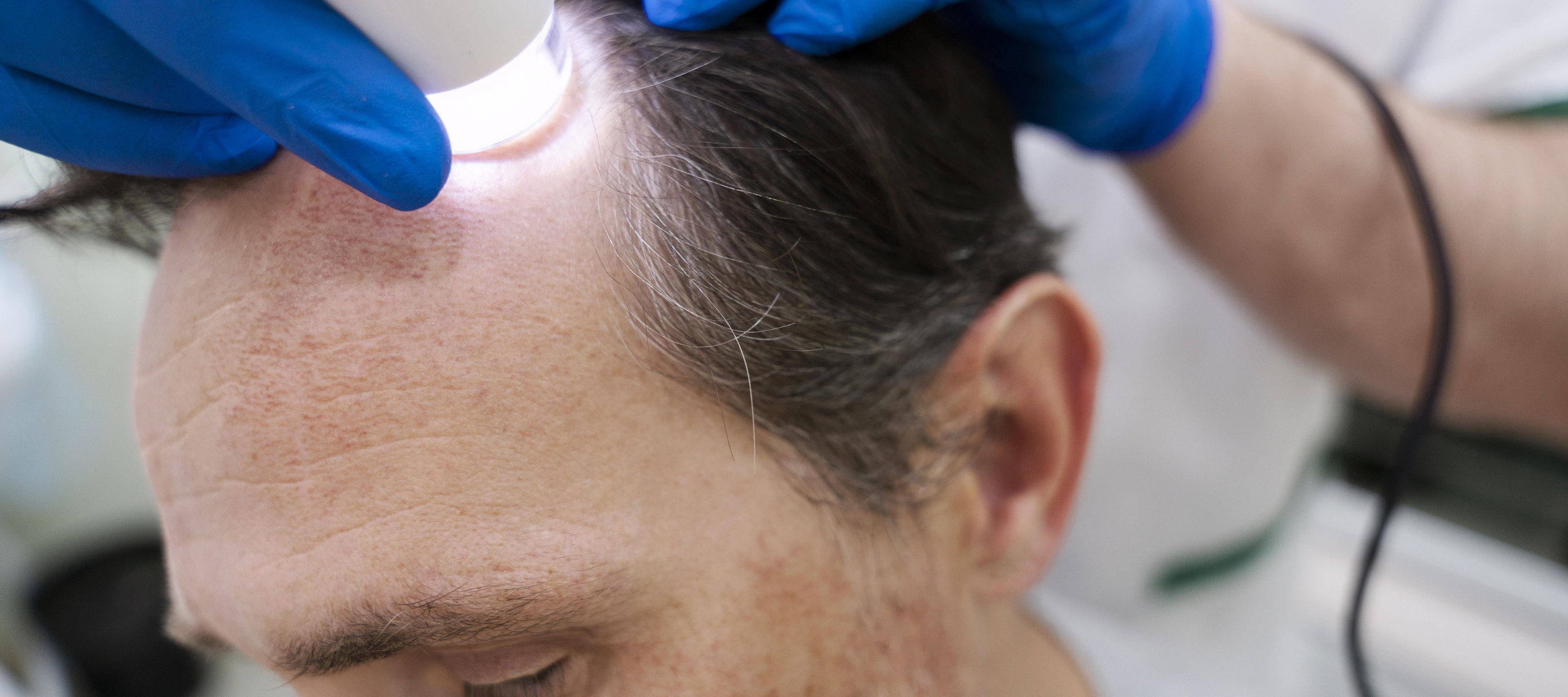 Man getting his scalp looked at