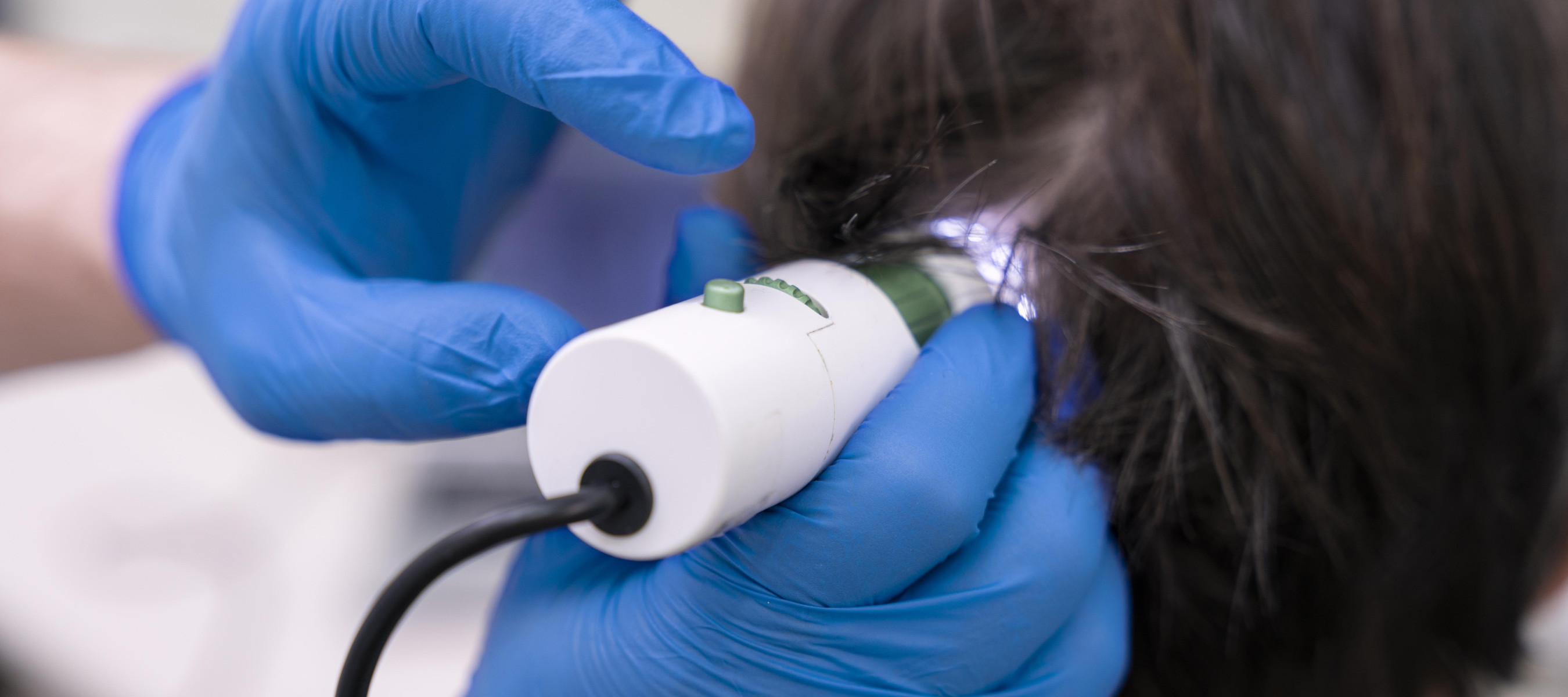 Man getting scalp analysis