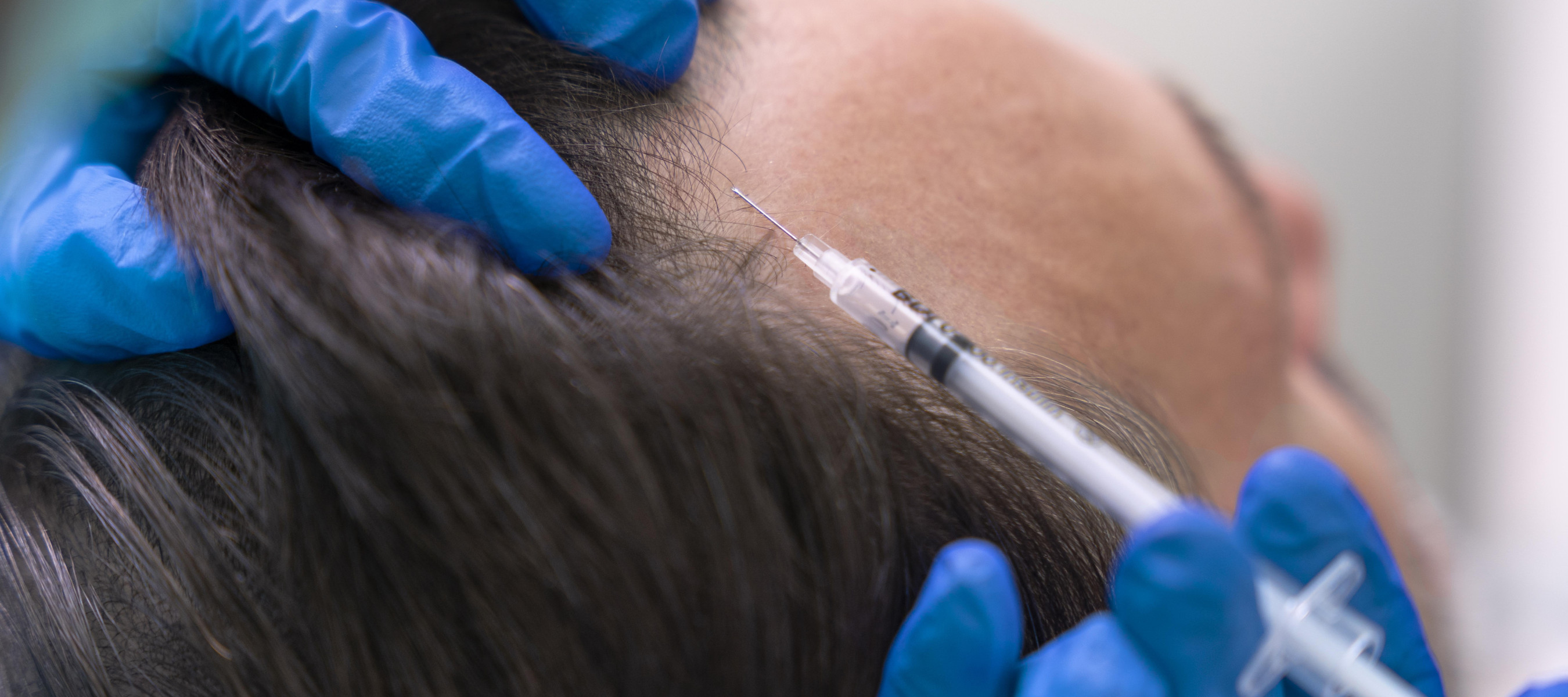 Man Receiving Scalp Injection