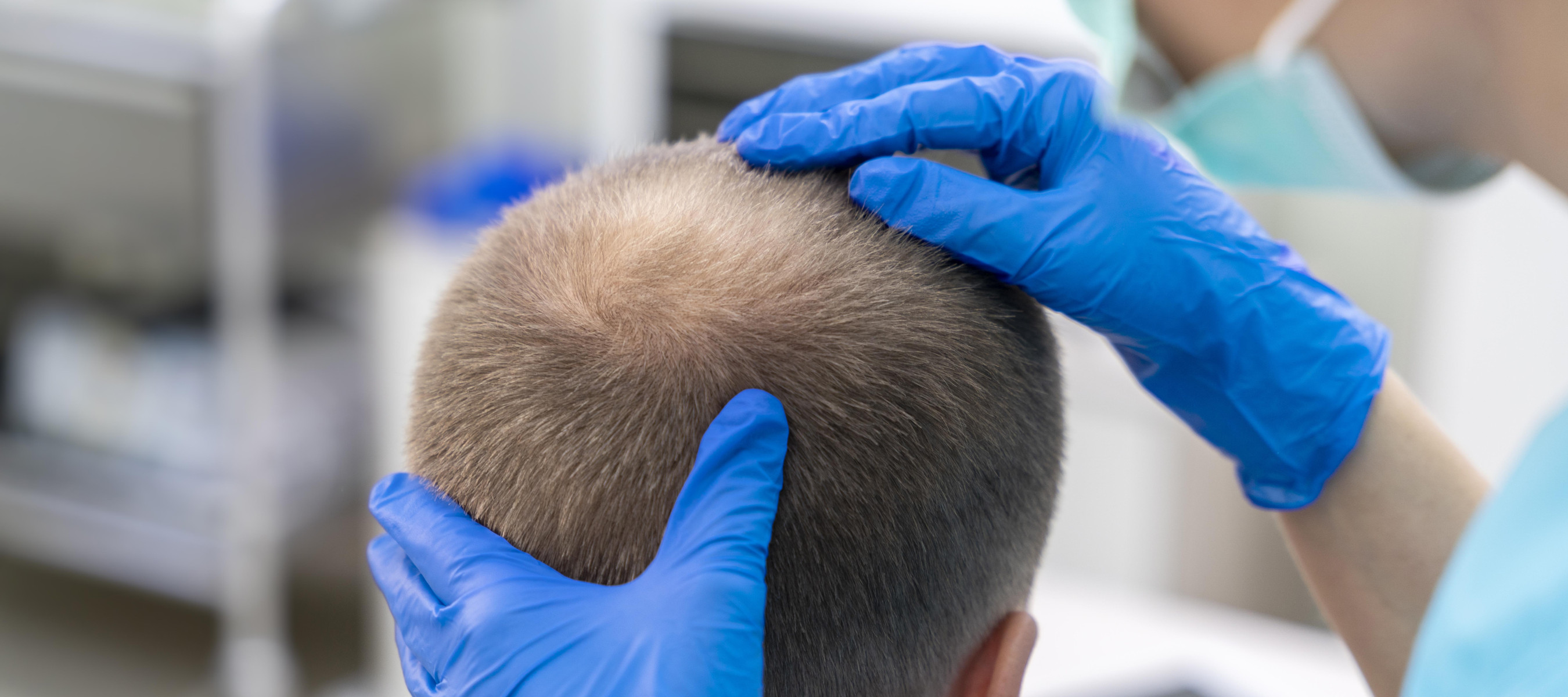 Female specialist emamining a man's thin hair