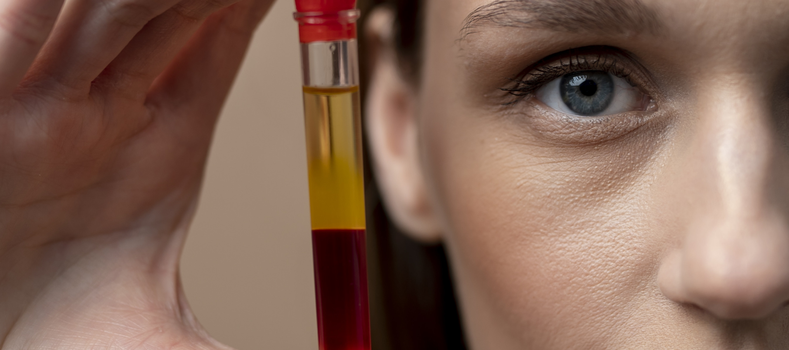 Young womn holding a blood vial