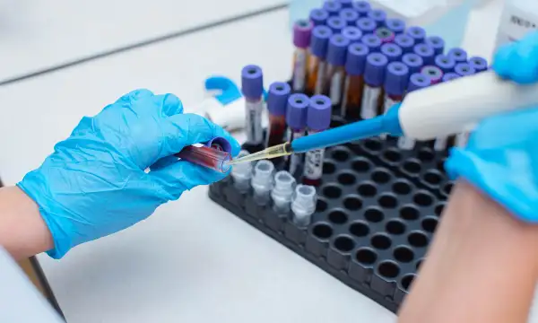Hormone Screening Panel