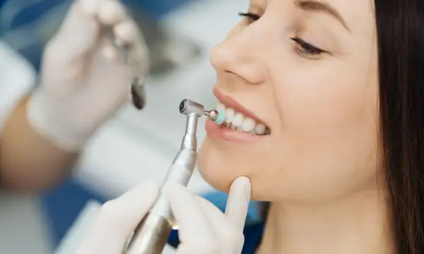 Teeth Cleaning in Bangkok
